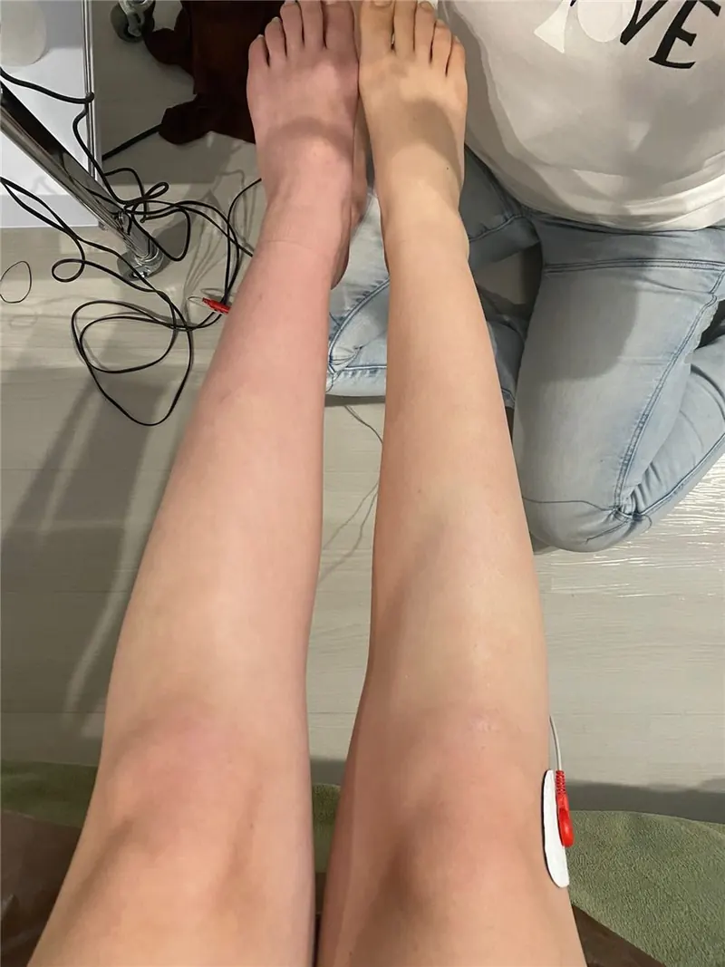 伊藤超短波EMS